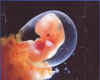 6 weeks embryo