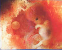 11 weeks embryo